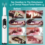 CURVY MOON Dog Use Ultrasonic Tooth Cleaner Dog Cat Pet Dental Scaler for Tartar Removal Teeth Cleaning Tool with LED Light - Image 4